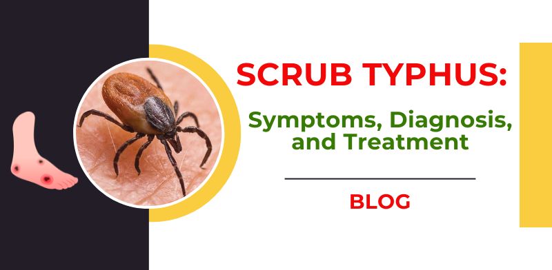 Scrub Typhus